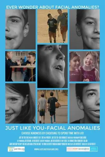 Just Like You: Facial Anomalies_peliplat