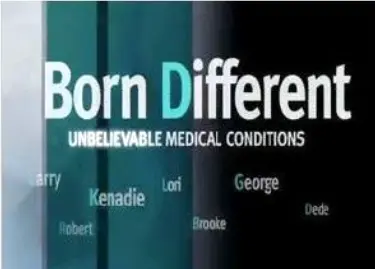 Born Different: Unbelievable Medical Conditions_peliplat