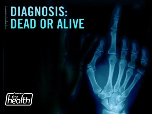 Diagnosis: Dead or Alive_peliplat