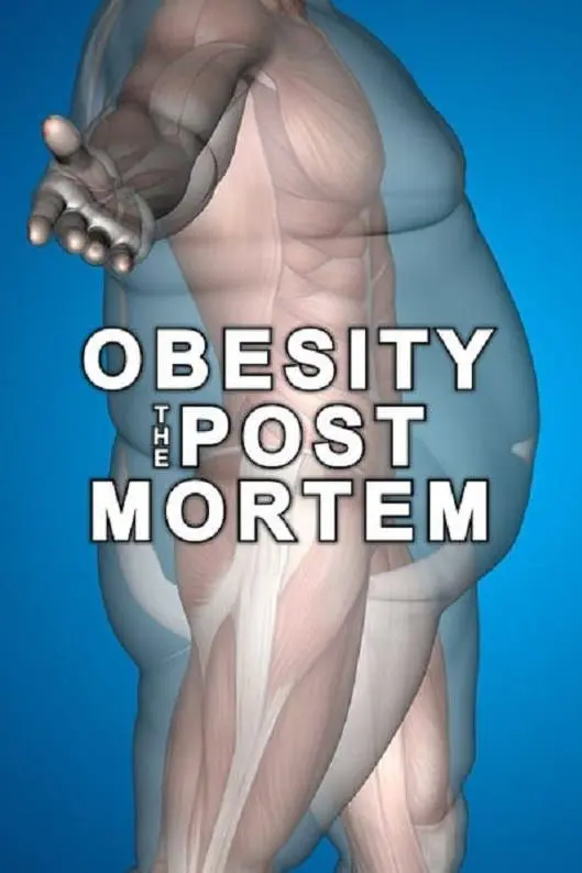 Obesity: The Post Mortem_peliplat