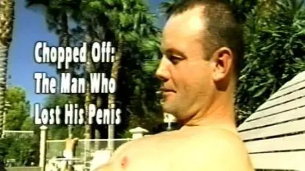 Chopped Off: The Man Who Lost His Penis_peliplat