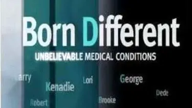 Born Different: Unbelievable Medical Conditions_peliplat