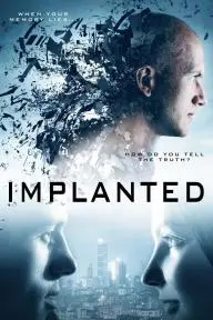 Implanted_peliplat