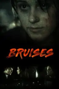Bruises_peliplat