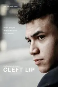 Cleft Lip_peliplat