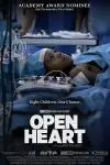 Open Heart_peliplat